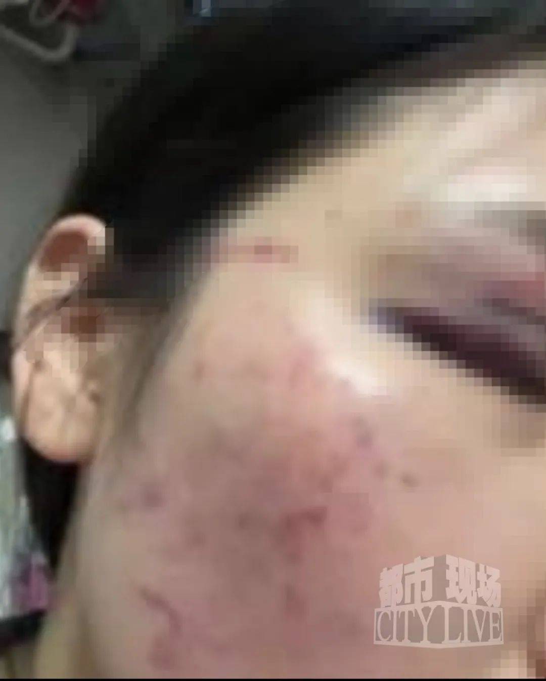 皇冠信用网代理流程_湖南衡阳29岁女子疑被男友施暴后从25楼跳下身亡 男友徐某此前还刺激说:“你放心皇冠信用网代理流程,她不会去死的”